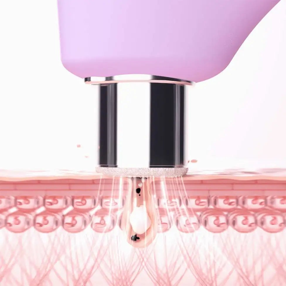 Diamond Microdermabrasion: The Luxury Skin Renewal Treatment Bringing Professional Results Home