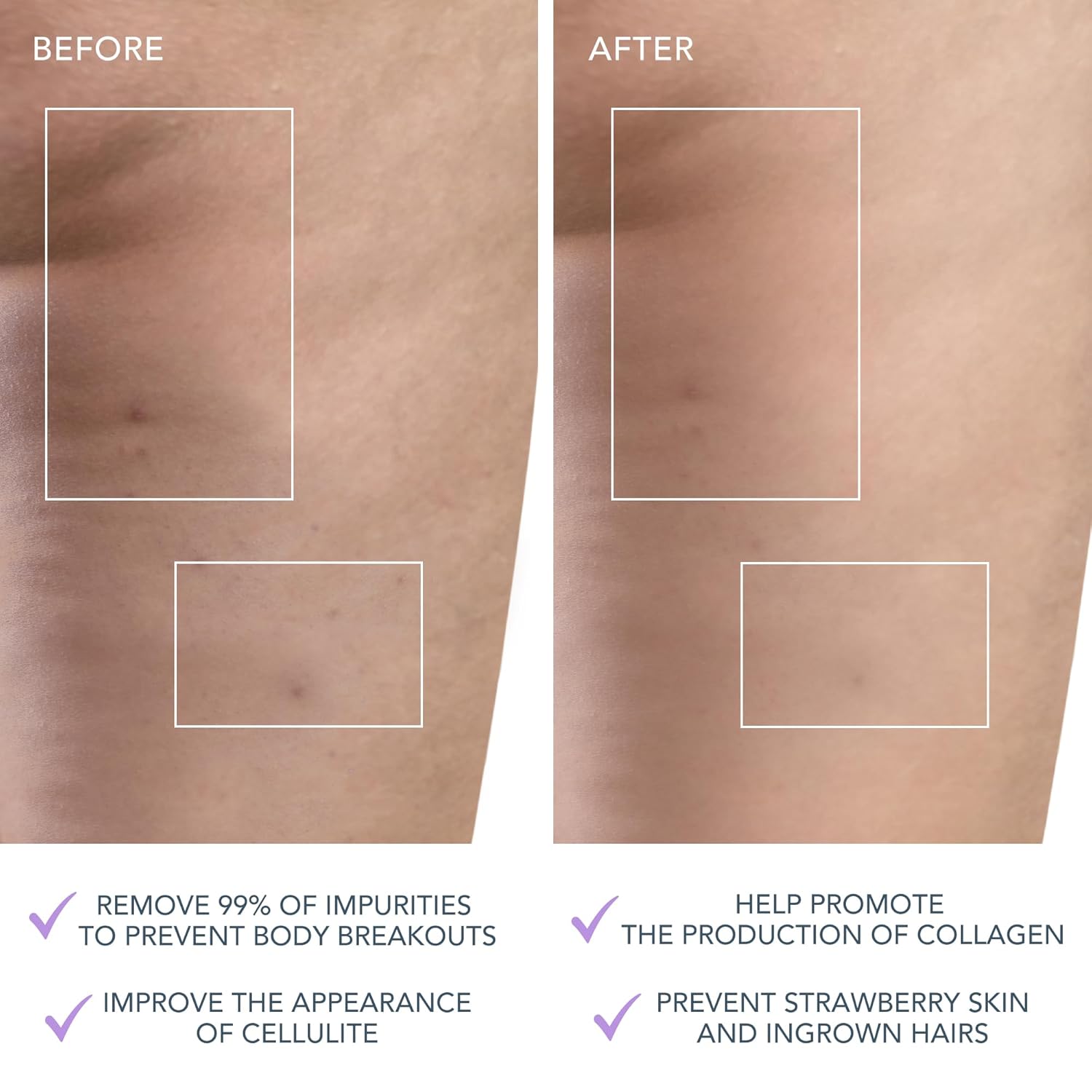 Before and after comparison of skin treatment on a person's leg, highlighting improvements.
