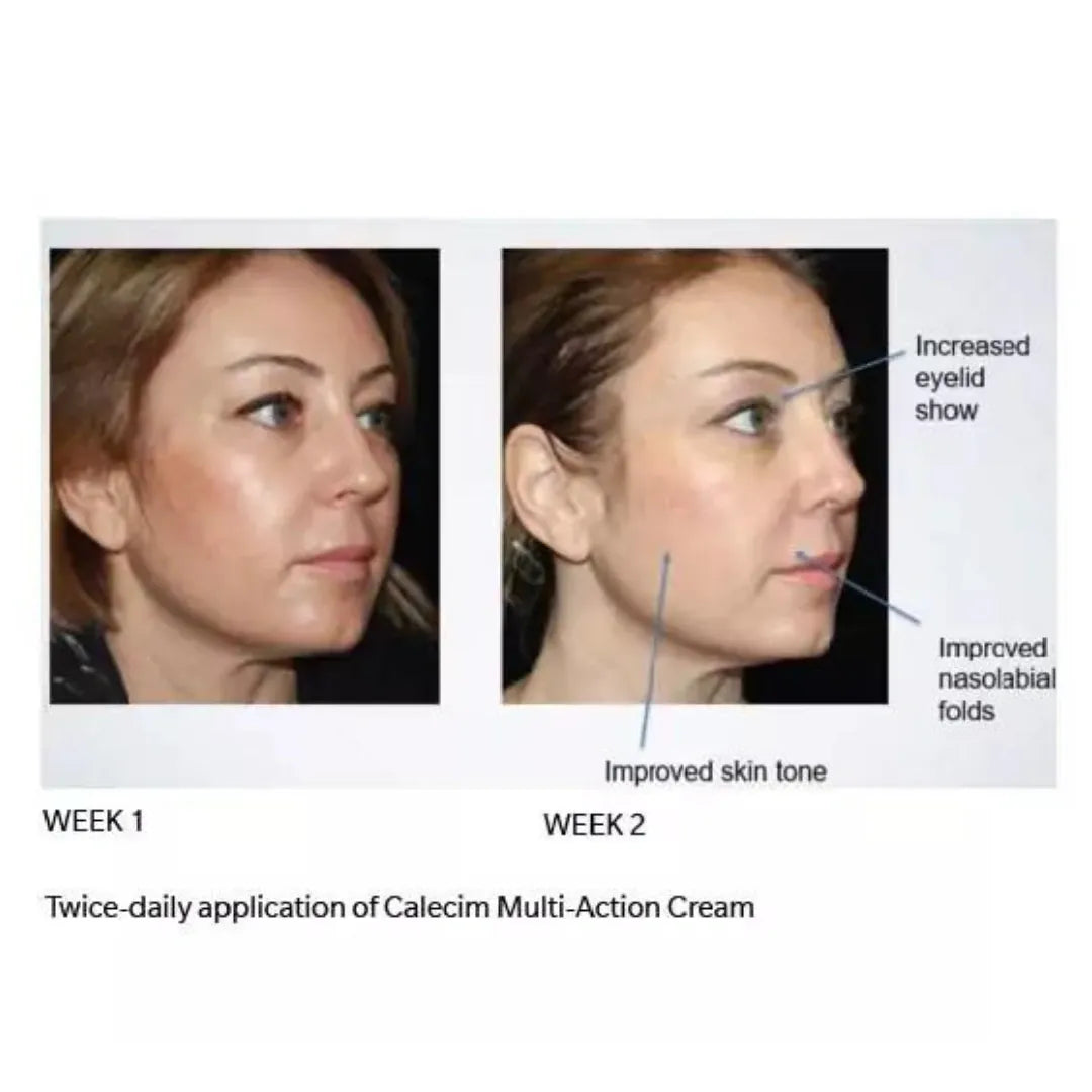 Calecim Professional Pigment Solution - 30G