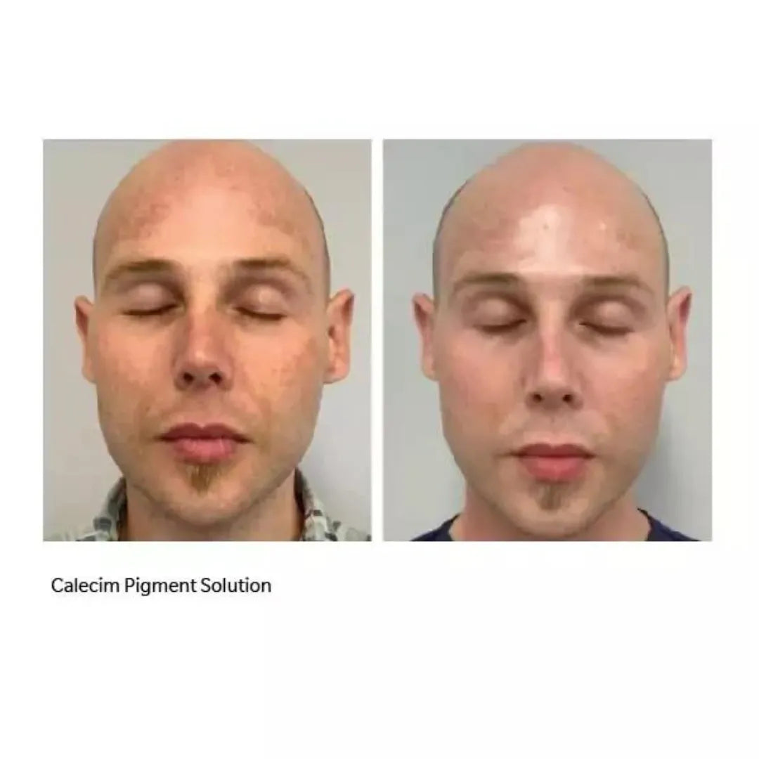 Calecim Professional Pigment Solution - 30G