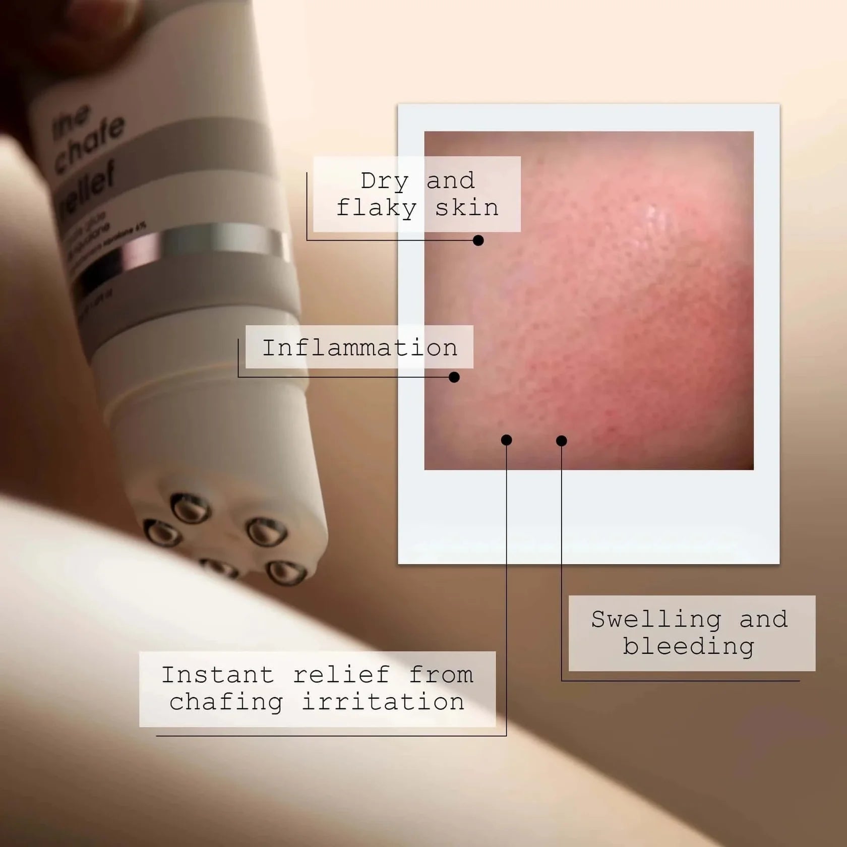 Product for chafing relief with labeled skin conditions and a close-up of skin texture.