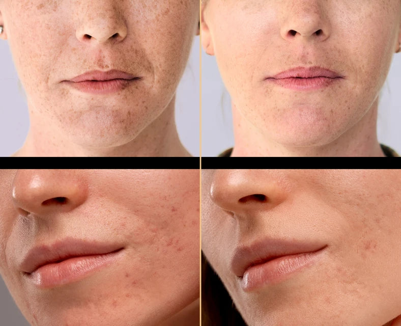 Four close ups of person's skin