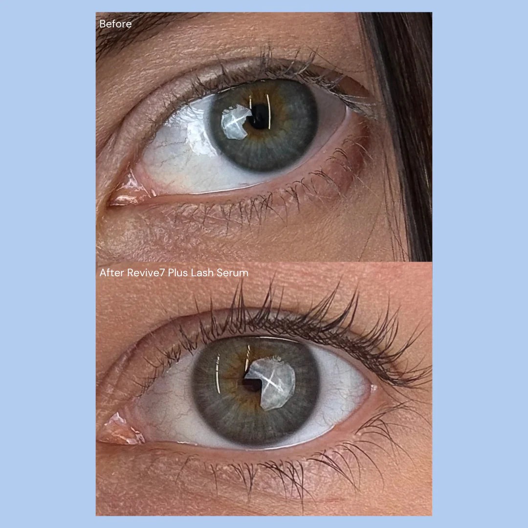 Before and after comparison of an eye with Revive7 Plus Lash Serum application.
