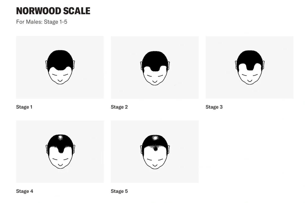 Hair System Norwood Scale Male