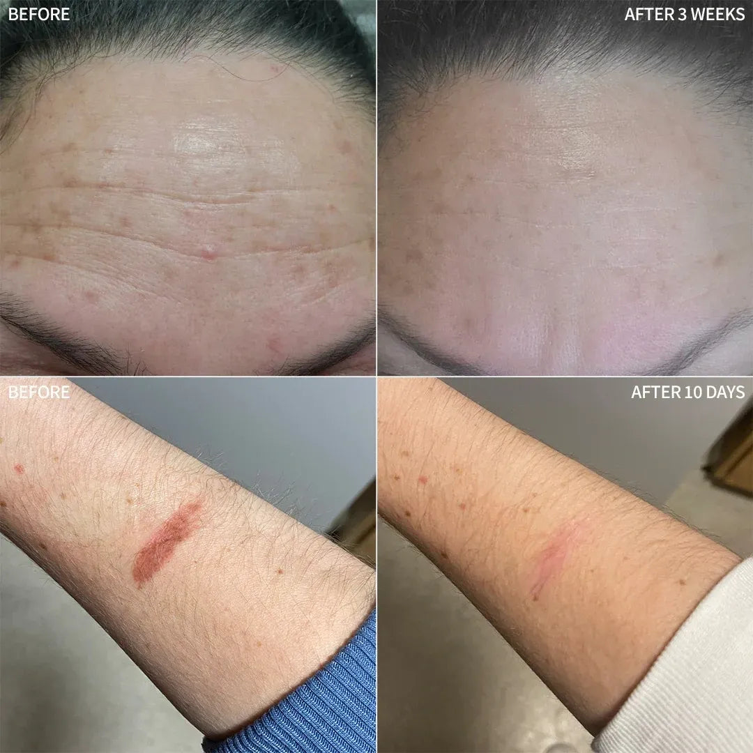 RescueMD DNA Repair Complex The Ultimate Skin Damage + Scar Treatment