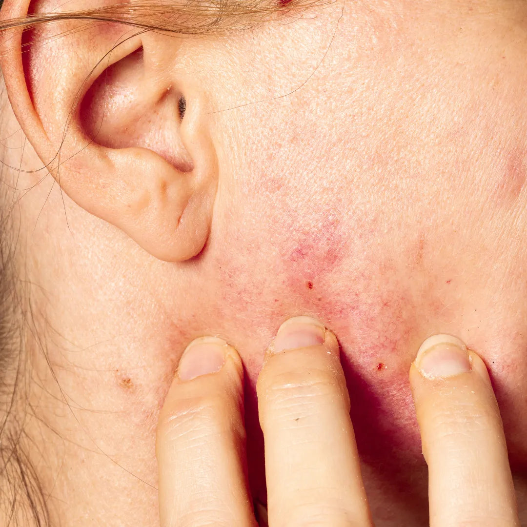 Inflammaging: The Hidden Reason Your Skin May Be Aging Faster