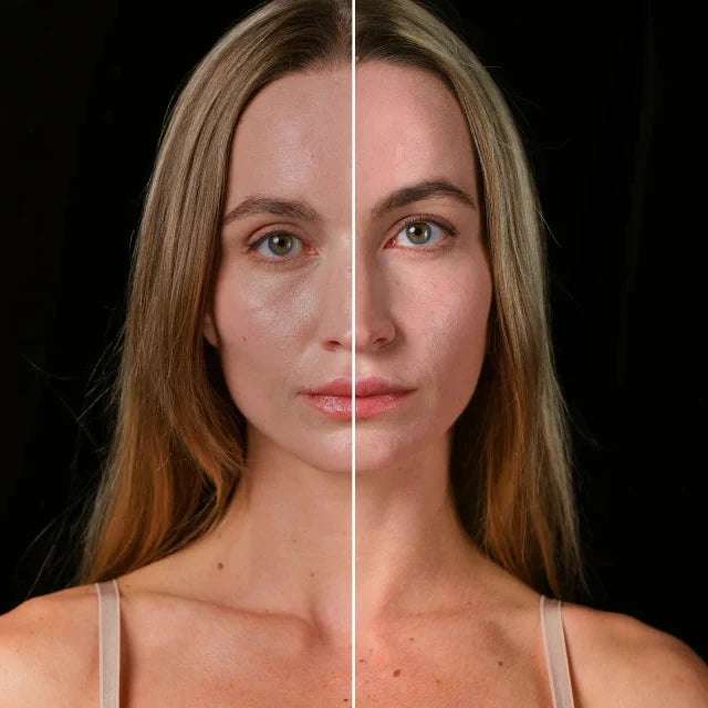 5 Signs Your Skin Barrier Needs Support
