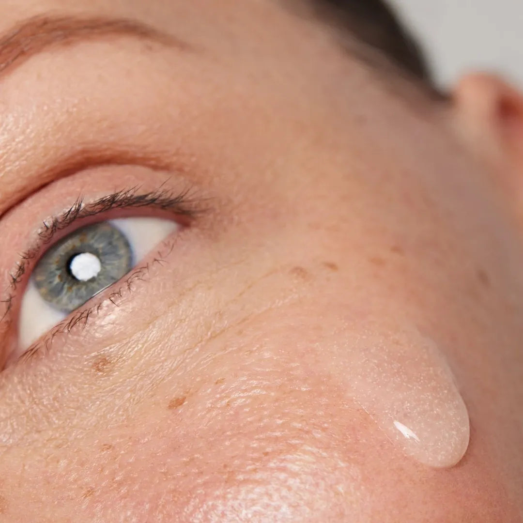 close up of woman's cheek with serum dripping down cheek