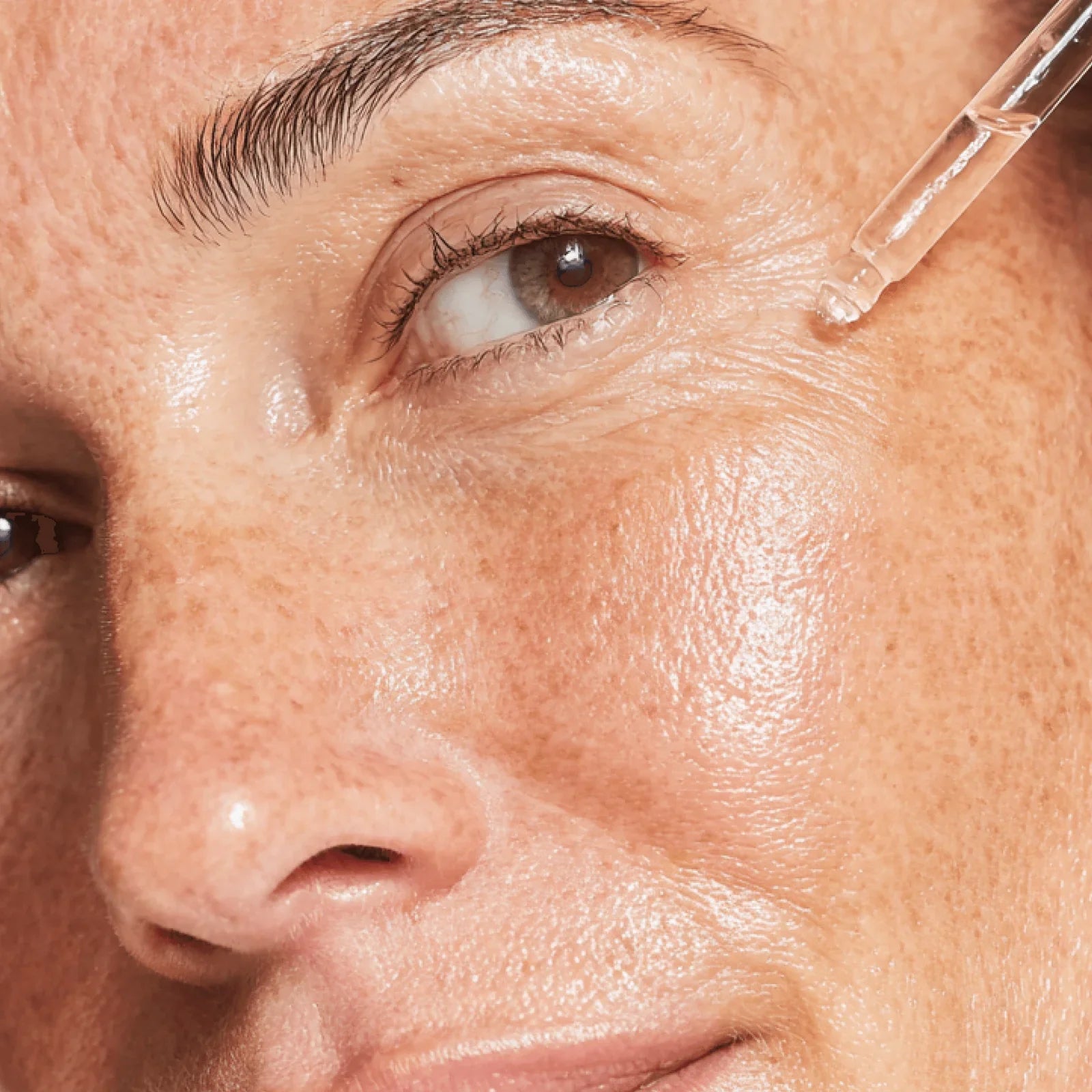 Why Topical Skincare Alone May Not Be Enough for Clear, Healthy-Looking Skin