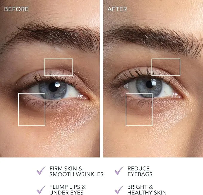 Before and after side by side photos of close up of eyes