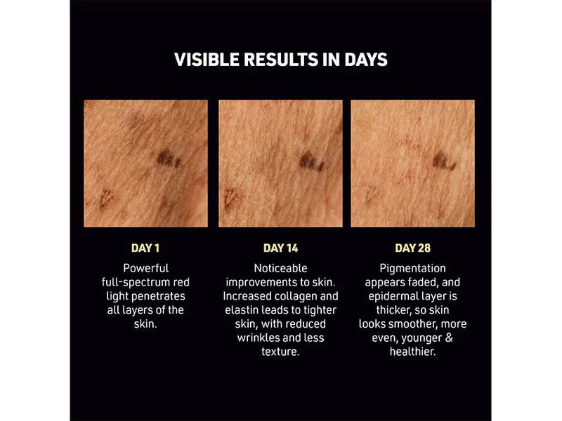 Diagram showing visible skin improvement results over 28 days with text describing each stage.