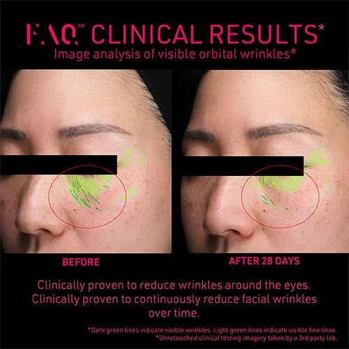 FAQ Clinical results imaging on person before and after 28 days