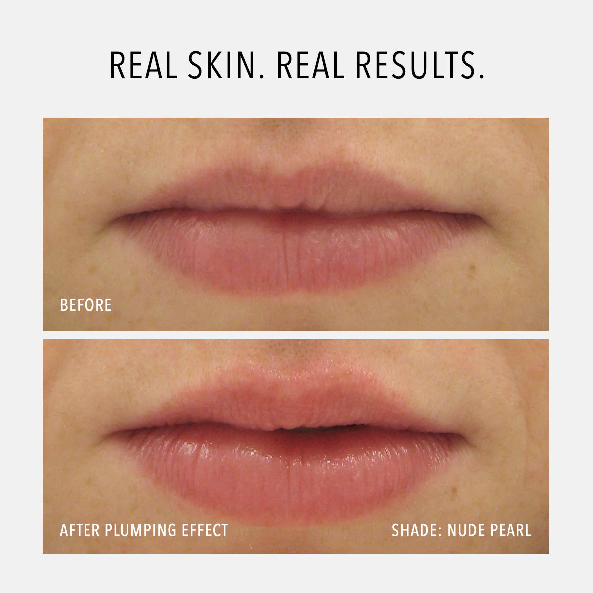 Before and after comparison of lips with a plumping effect, labeled 'Real Skin. Real Results.'
