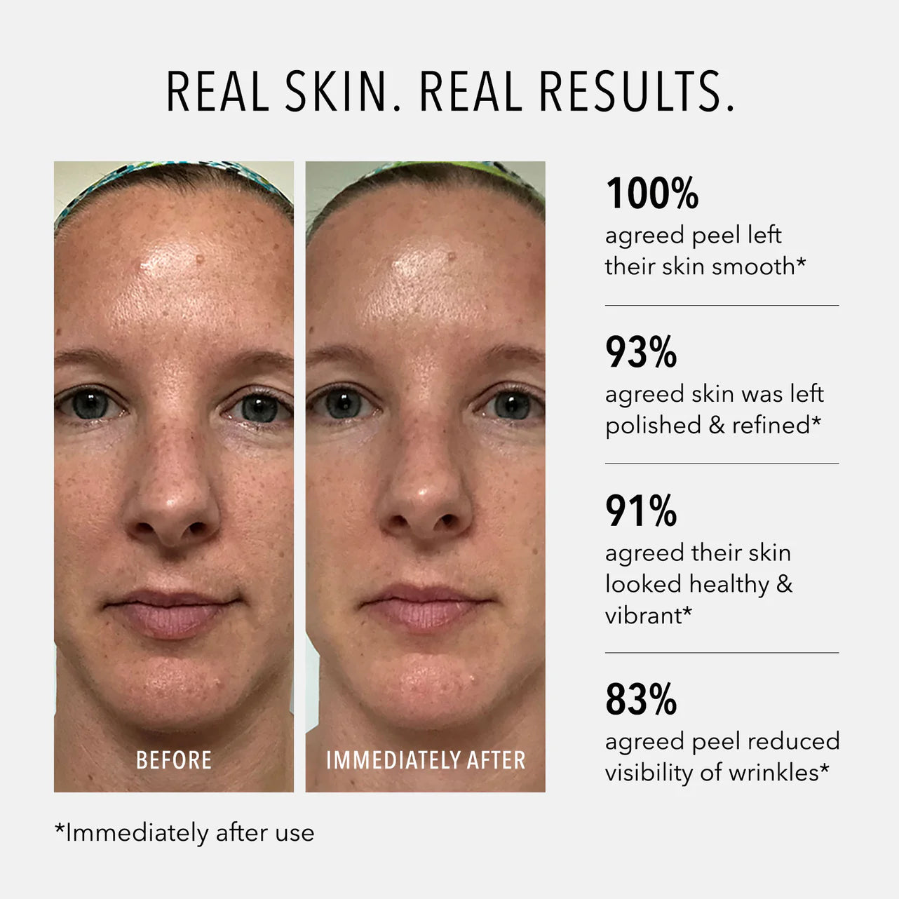 Before and after skin comparison with positive feedback on a white background