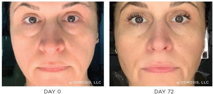 Osmosis Professional Recovery Gel Caps