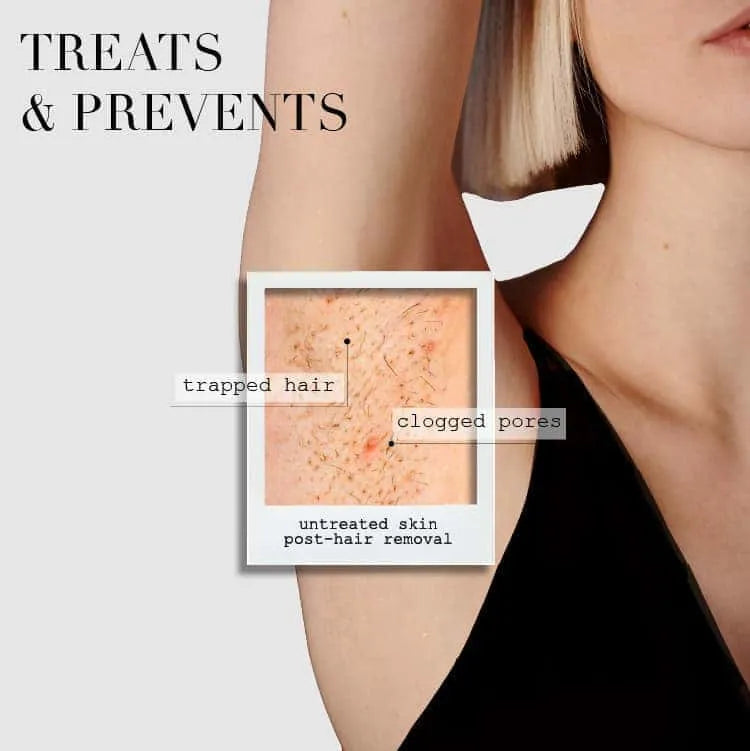 Advertisement showing a person's arm with text about skin issues and treatment solutions.